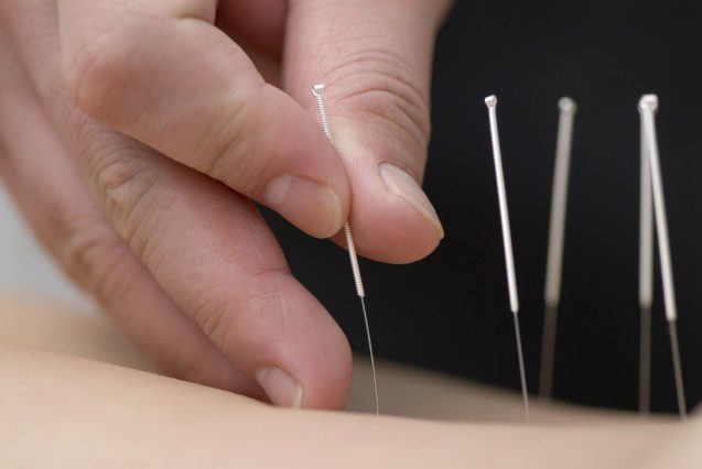 Hand inserting acupuncture needles into skin