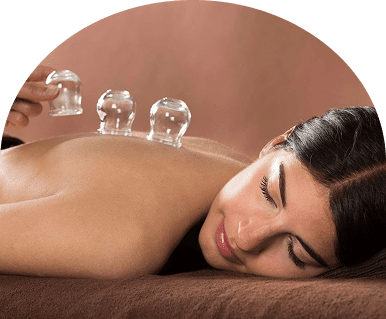 Woman receiving glass cupping therapy